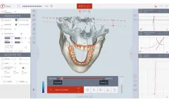 Modjaw - Version Advanced TWIM - Twin In Motion Software
