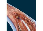 PowerWire - Model Pro RF - Guidewire for Vascular Occlusions