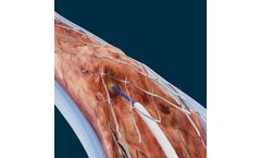 PowerWire - Model Pro RF - Guidewire for Vascular Occlusions