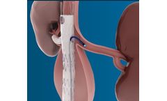 PowerWire - Model Pro RF - Guidewire for Vascular Navigation