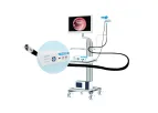 Soudon Medical - Choledochoscope Set for Medical Diagnosis and Treatment