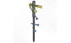 Bonetech - Model BON-MHN - Multilock Proximal Humerus Nail