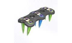 Bonetech - Model Symplex II - Anterior Cervical Plate