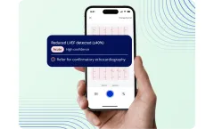 PMcardio - Version LVEF - Rapid and Accurate Assessment Software