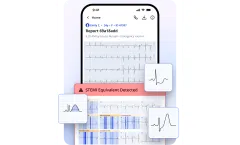 PMcardio - Version STEMI - Platform for AI-Powered ECG Diagnostics