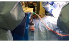 collection clip for the HBP - Video