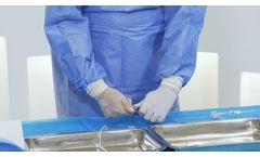 Lava Liquid Embolic System - Video