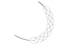 NeuroSafe - Model Dredger - Revascularization Device for Acute Ischemic Stroke