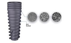 Medosis - Conical Connection Dental Implants