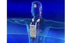 Vivosonic Integrity - Video