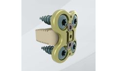 Spineway - Interbody Fusion System for Spinal Stability