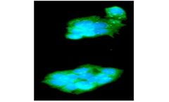 AAA Biotech - Model TREM2  - Mouse anti-Human Monoclonal Antibody