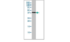 AAA Biotech - Model BAG1  - Mouse Monoclonal Antibody