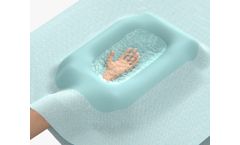 Sono-Bath - Medical Device for Dupuytren’s Contracture Surgery