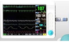AURA - ICP Monitoring System