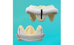 Abbott - Model EPIC Plus - Mitral and Aortic Stented Tissue Valves for Heart Valve Replacement