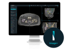 MVision - Version Image+ - Radiotherapy Planning Software with Synthetic Imaging