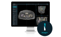 MVision - Version Image+ - Radiotherapy Planning Software with Synthetic Imaging