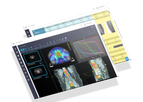 RT Connect - Integrated Radiotherapy Management Software