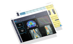 RT Connect - Integrated Radiotherapy Management Software