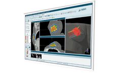 SagiPlan - Treatment Planning Software (TPS) for All HDR Applications