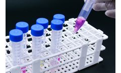 Toxys ToxTracker - Model ACE - Assay for Genotoxicity Analysis