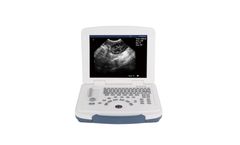 IVETWELL - Model IVT-CU3 - Portable Veterinary Ultrasound Diagnostic System for Efficient Pet Care Solutions