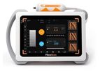 Echosens FibroScan - Model Mini+ 430 - Mobile Non-Invasive Solution for Liver Disease Management