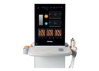 Echosens FibroScan Expert - Model 630 - Complete Non-Invasive Solution for Advanced Liver Disease Management