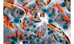Biofilm solutions for municipal water treatment industry