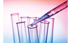 The serious risk of Total trihalomethane (TTHM) in drinking water