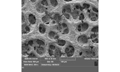 Nitrate Reduction Catalyzed by Bimetallic Silver-Copper Macroporous Foams