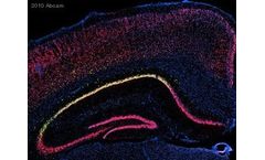 Abcam - Anti-GFP Antibody