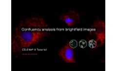 Confluency analysis from brightfield images Video