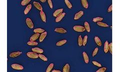 Grain Analyzer for Detection of Wheat Phenotypingand Grading