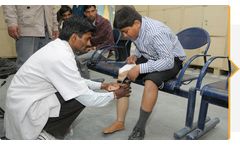 Below-Knee Prosthesis