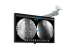 Stryker - Version SpineMap Go - SpineMap Augmented Fluoroscopy Software