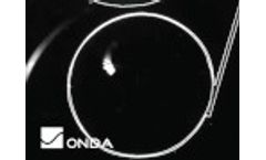 Ultrasound Image of Waves Hitting Large Aluminum Tube - Video