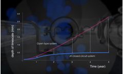 How to update your cooling system solve the problem of limescale?