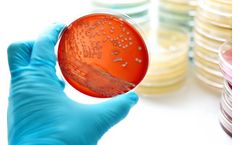 Bacteria Preservation with Froilabo