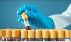 ATR-FTIR of Blood Serum Using a Heated ATR Accessory
