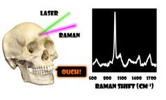 Shining a Light on Bone Composition Using Raman Spectroscopy