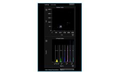 QbSure - Quality Control Program Software