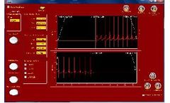 Phipps-Bird - ECG System for Cardiac Studies