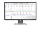 ecgAUTO - Cardiovascular Data Analysis Software