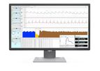 IOX2 - Physiological Data Acquisition & Analysis Software