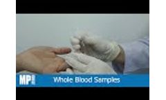 ASSURE SARS-CoV-2 Antibody rapid test kit - user instructional video - Video