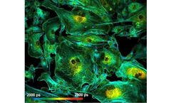 Boston Electronics - Time-Correlated Single Photon Counting (TCSPC) Technology