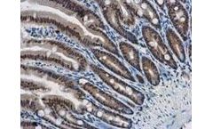 GeneTex - Model HRP-GTX213110-01 - Goat Anti-Rabbit IgG Antibody