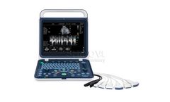 Shinova - Model DopScan 6060V - Portable Veterinary Color Doppler